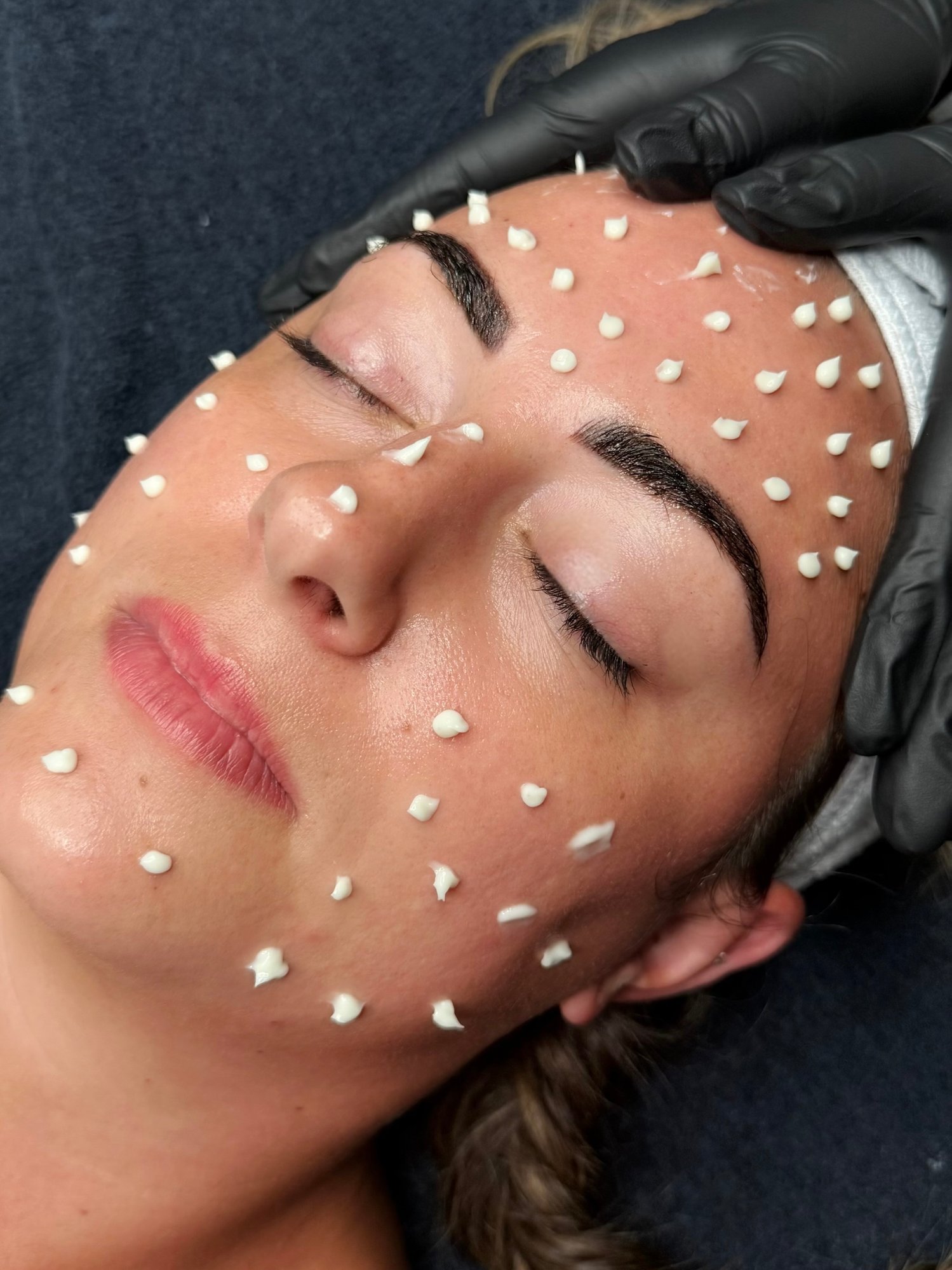 liquid microneedling facial liquid microneedling facial