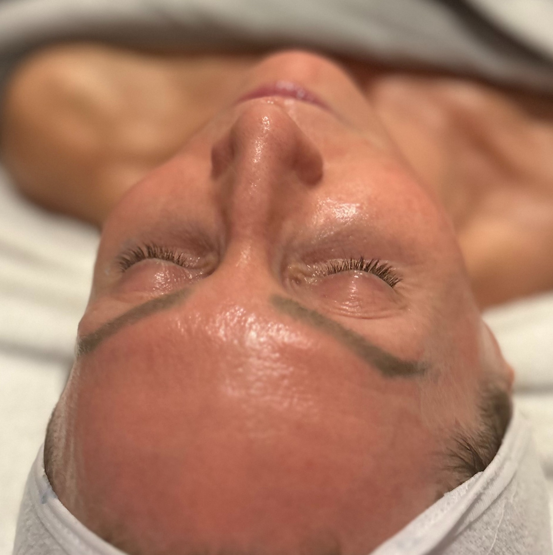 hydration facial