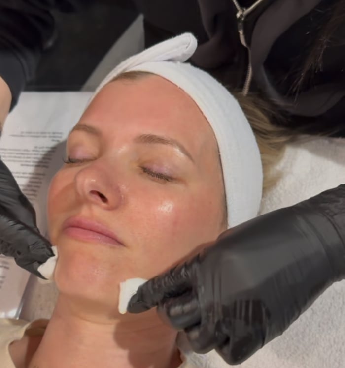 Red Carpet Chemical Peel image