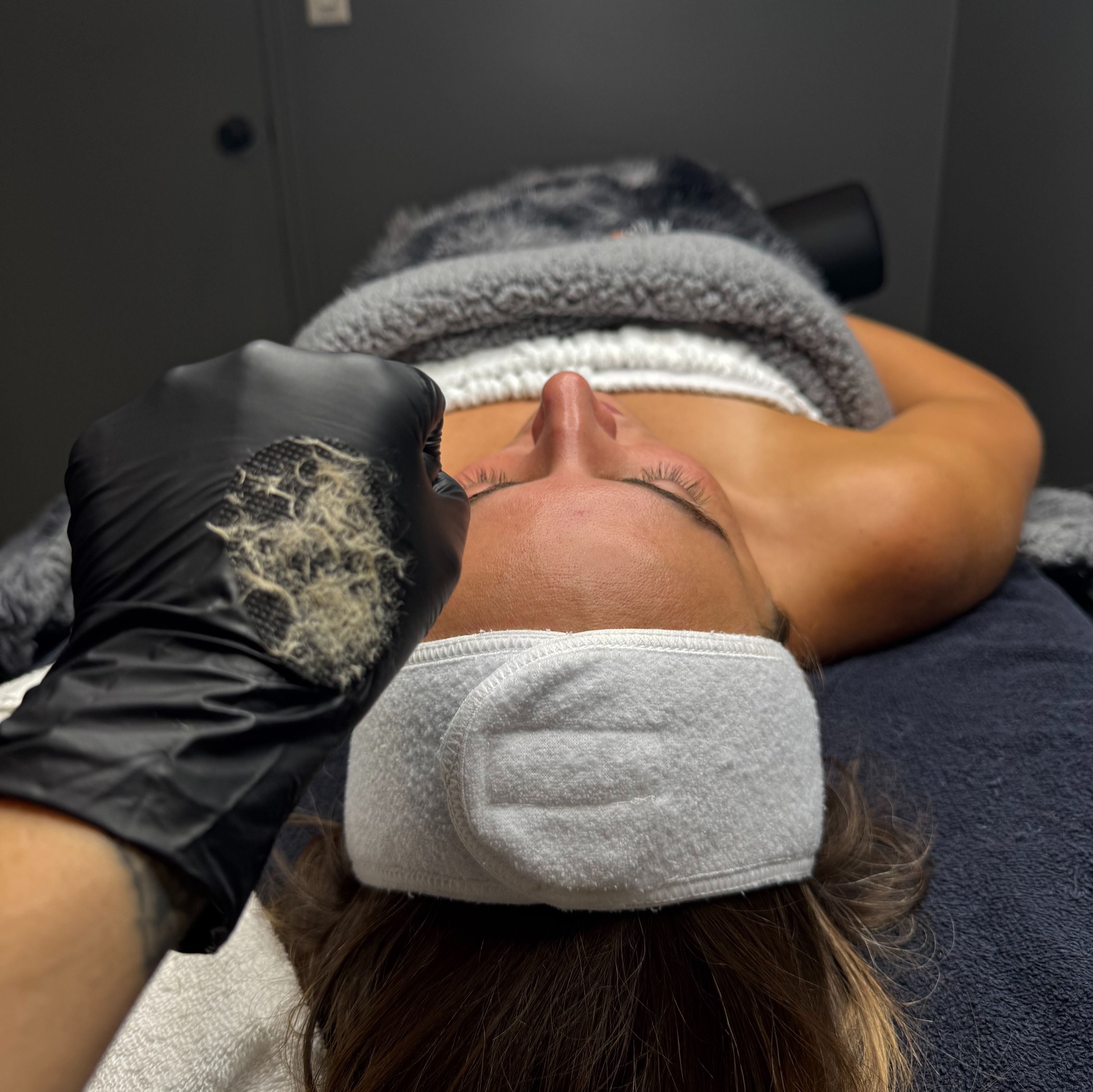 Dermaplane facial by Stacey