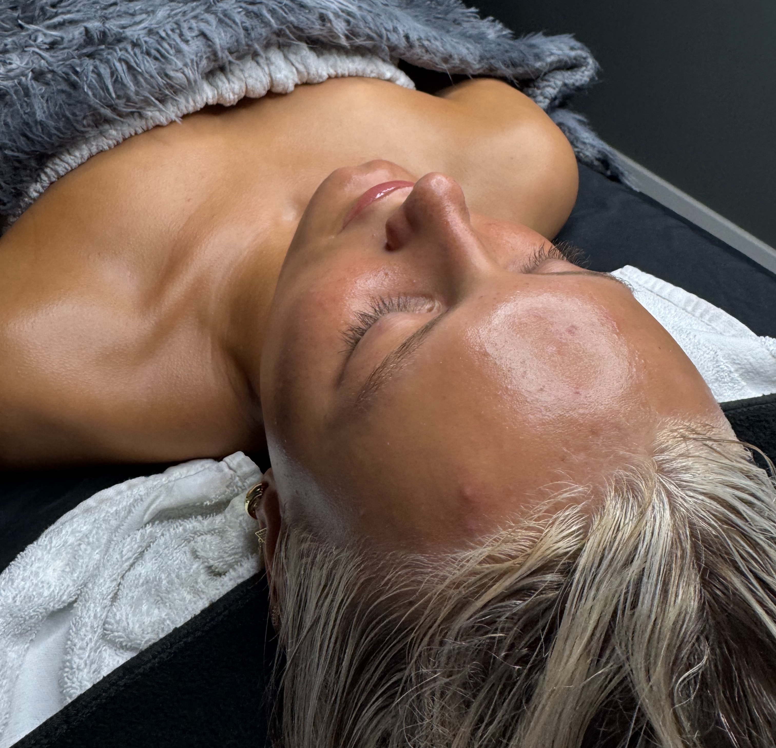 Hydration facial by Stacey